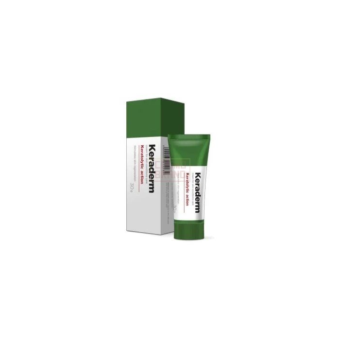 ⌠ Keraderm ⌡ ⌠ papilloma cream ⌡